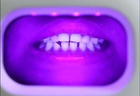 i-Cute innowacyjny skaner czystości zębów do użytku domowego - biały